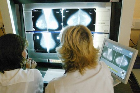 Doctors warn women: 'get checked' after borough's high breast cancer rate revealed - East London and West Essex Guardian Series